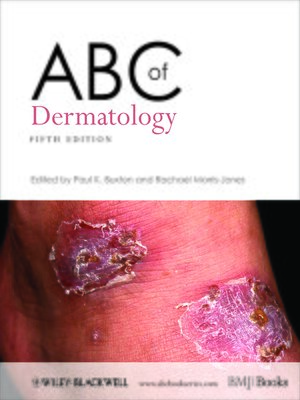cover image of ABC of Dermatology